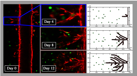 computational image of tumor cells
