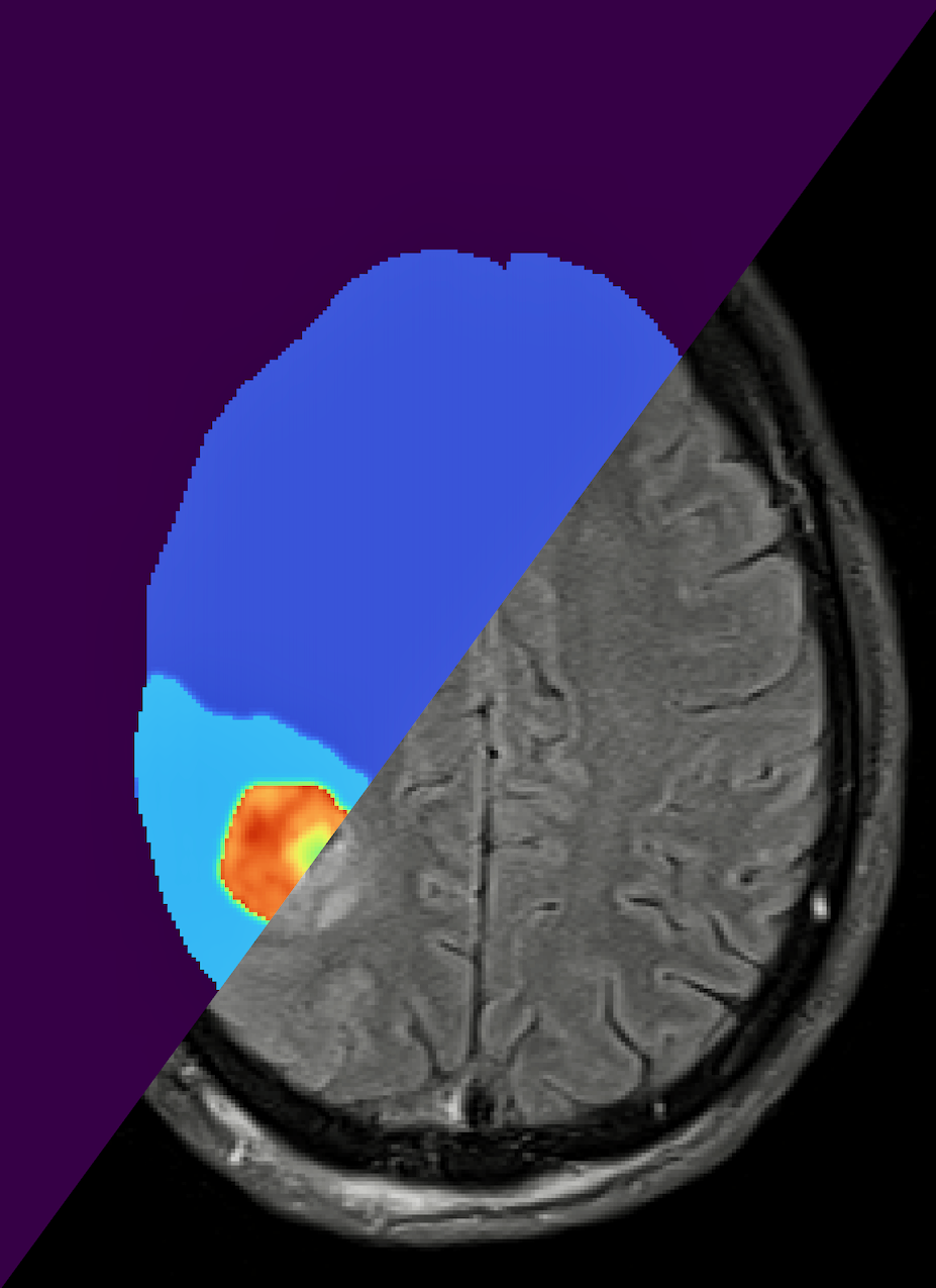 Graphic: A human brain and its digital twin.